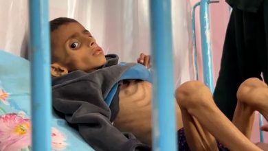 صورة الأونروا: طفل من كل ثلاثة بغزة لم يتناول طعاما خلال 24 ساعة