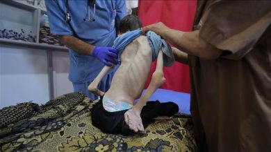 صورة غزة: ارتفاع وفيات التجويع الإسرائيلي إلى 162 فلسطينيا بينهم 92 طفلا