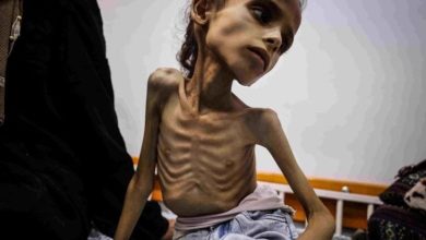 صورة صحة غزة: ارتفاع شهداء التجويع الإسرائيلي إلى 193 بينهم 96 طفلا