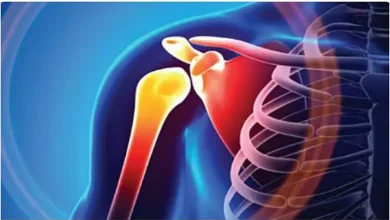 صورة استشاري يوضح مفهوم كسر العظام المضاعف وأسبابه
