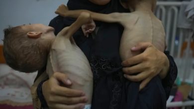 صورة بعد تسجيل 5 حالات وفاة جديدة.. حصيلة شهداء سياسة التجويع الإسرائيلي في قطاع غزة ترتفع لـ387 بينهم 138 طفلا