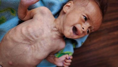 صورة اليونيسيف” تحث على تدفق المساعدات لغزة وتحذر من ارتفاع وفيات الأطفال