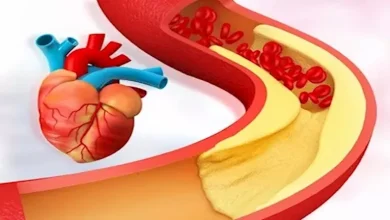 صورة 8 طرق فعالة لخفض الكوليسترول الضار.. عليك اتباعها