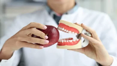 صورة كيف يؤثر النظام الغذائي على صحة اللثة؟