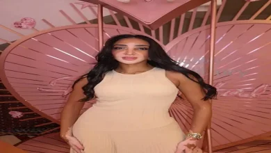 صورة خطفت الأنظار في إيطاليا.. من هي أول ملكة جمال مصرية مصابة بالبهاق؟