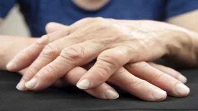 صورة ما أسباب وأعراض وعلاج الفصال العظمي؟