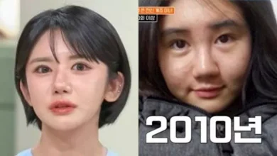 صورة خلال 15 عاما.. امرأة تنفق ثروة ضخمة على 400 عملية تجميل