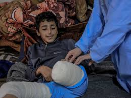 صورة الصحة الفلسطينية: غزة تسجّل أعلى معدل لبتر الأطراف لدى الأطفال نسبةً لعدد السكان عالمياً