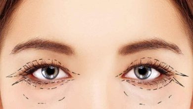 صورة استشاري: عمليات تجميل الجفون آمنة بشرط