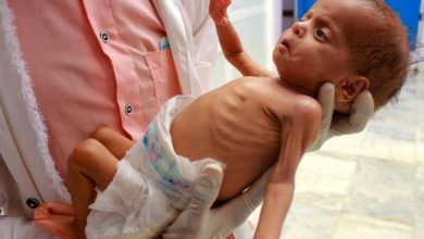 صورة مسؤول أممي: تأثيرات سوء التغذية بغزة ستمتد لأجيال