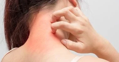 صورة اليوم العالمى للصدفية: كيف نفهم معنى المرض المناعى