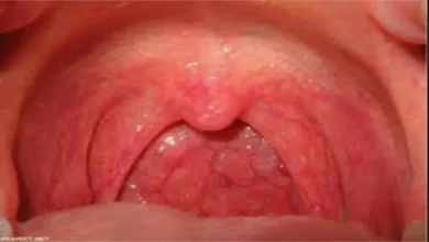 صورة أصوات وإنذارات من جسدك.. إشارات مبكرة قد تدل على سرطان الحلق