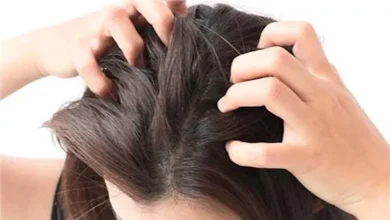 صورة أسباب حكة الجلد وفروة الرأس وطرق تخفيفها