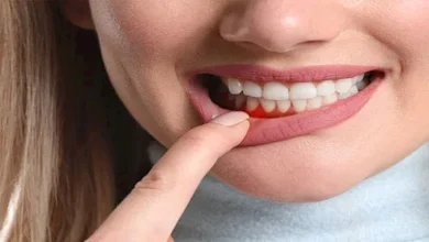 صورة دراسة: أمراض اللثة تزيد من خطر الإصابة بأمراض القلب والسكتات الدماغية