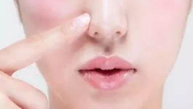صورة كيف تميز التهاب الأنف؟ 5 علامات تحذيرية مهمة