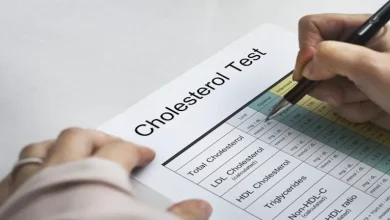 صورة احذر تجاهلها.. 4 حقائق عن الكوليسترول وعلاقته بالقلب