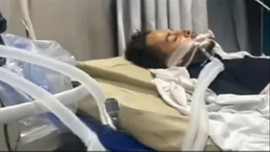 صورة مطرب مصري يصارع الموت بعد حادثة مروعة  أخبار السعودية