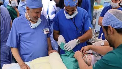 صورة التوائم الملتصقة حالات نادرة تصيب واحد من كل 200 ألف