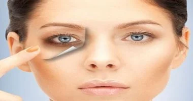 صورة وصفات طبيعية للتخلص من الهالات السوداء تحت العين بدون كونسيلر