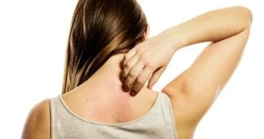 صورة أطباء يحذرون من ارتفاع حساسية الطعام لدى البالغين