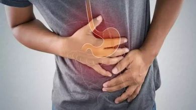 صورة علامات وأسباب قرحة المعدة وكيفية علاجها
