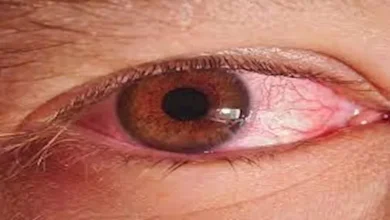 صورة دراسة: عادة بسيطة قد تقلل تهيج العينين والاحمرار