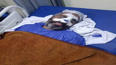 صورة “شرخ بالضلع و8 غرز”.. مدرب أبو قير يكشف لمصراوي كواليس اشتباك الترسانة