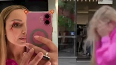 صورة مراسلة تلفزيونية تنزف على الهواء مباشرة بسبب موقف غريب.. ما القصة؟