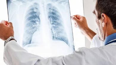صورة الصحة: يمكن الوقاية من 30 إلى 50 % من حالات السرطان