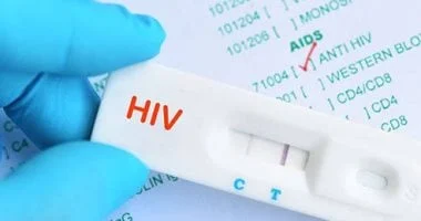 صورة هل يمكن الشفاء من فيروس نقص المناعة؟ نتائج واعدة من دراسة حديثة