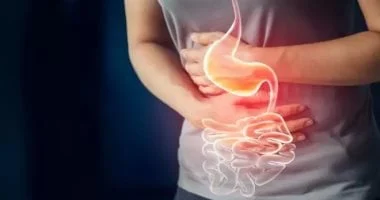 صورة عشر علاجات منزلية سهلة لحرقة المعدة