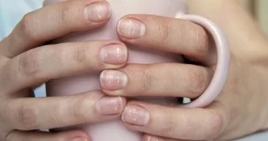 صورة ماذا تخبرك أظافرك عن صحتك؟