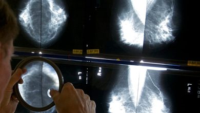 صورة دراسة: دواء يحاكي البروجسترون يعزز فعالية علاج سرطان الثدي ويبطئ نمو الأورام
