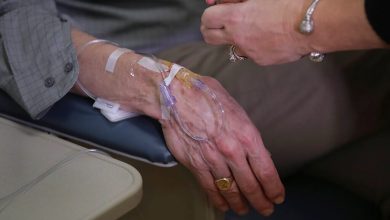 صورة مراجعة علمية واسعة تربط بين بكتيريا الأمعاء ومرض الزهايمر