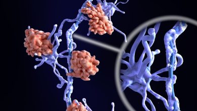 صورة استخدم العلماء الذكاء الاصطناعي لاكتشاف 2 من الأنماط الفرعية البيولوجية الجديدة للتصلب المتعدد