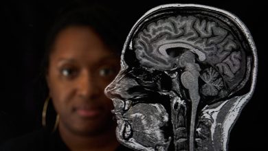 صورة نتائج علمية لافتة خلال 12 شهرا.. ماذا تفعل الرياضة بعمر الدماغ؟
