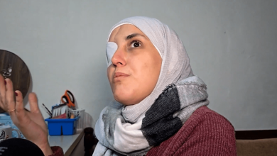 صورة فقدت زوجها وإحدى عينيها.. سورية تحول الحرف اليدوية لشريان حياة