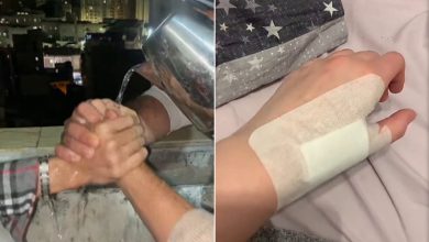 صورة شبكات يتناول تحدي الماء المغلي والطفل السوري الذي أنقذ حياة مريض في تركيا | منوعات